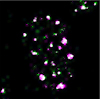 Localization of  a chromodomain protein (green) and SC-35 (magenta) under alpha-amanitin treatment in HeLa cell.